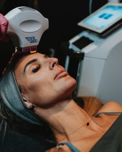 Woman receives the Moxi and BBL treatments to help reduce fine lines and wrinkles.